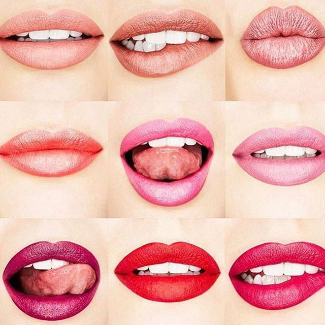 Lip Augmentation With Fillers