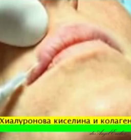 Хиалуронова киселина и колаген - приложение в естетичната хирургия, Предаване SYMETRIA, част 1, д-р Ангел Енчев в ТВ Здраве