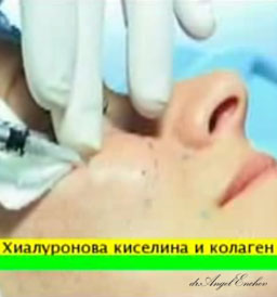 Хиалуронова киселина и колаген - приложение в естетичната хирургия, Предаване SYMETRIA, част 2, д-р Ангел Енчев в ТВ Здраве